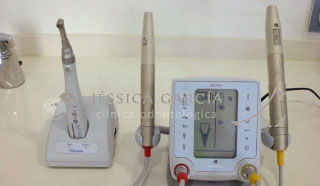 endodoncia-min-1